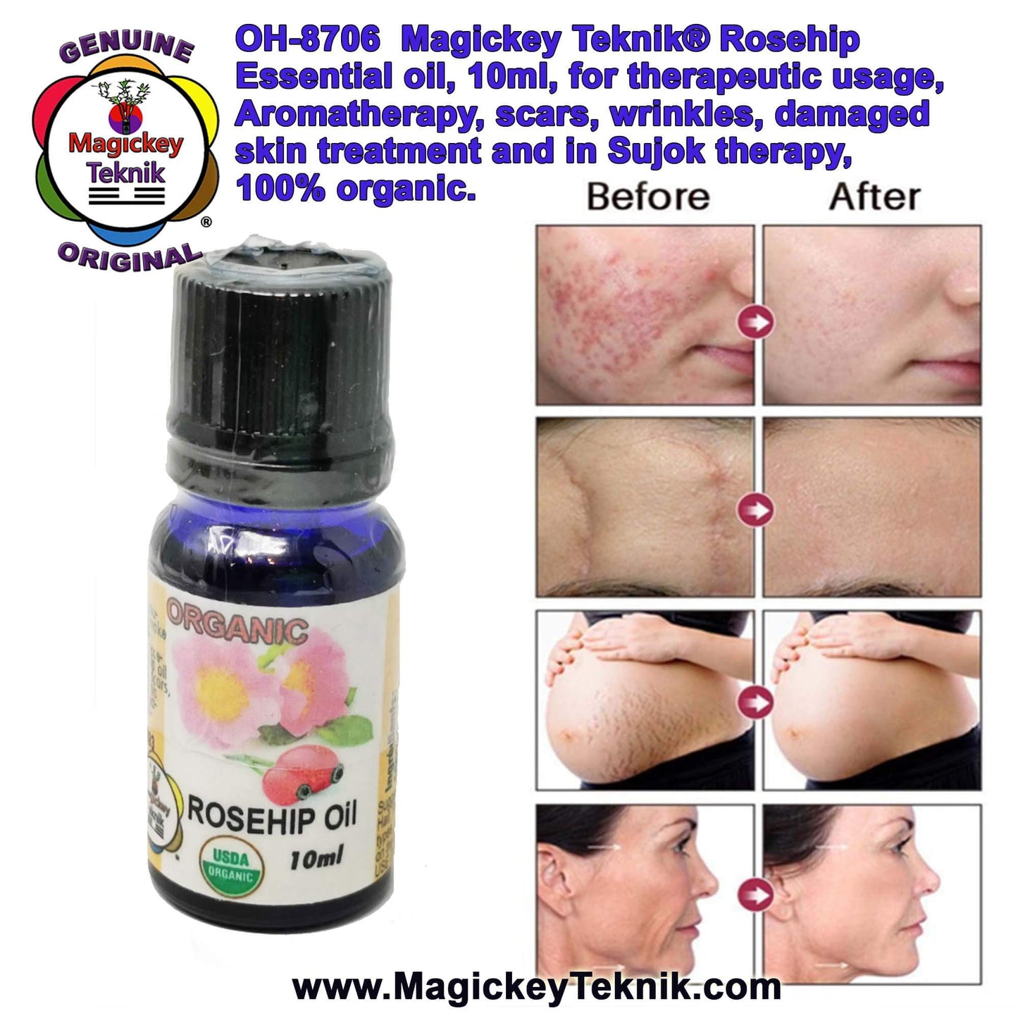 OH-8706 – Magickey Teknik® Rose Hip (Rosa Rugosa) Essential Oil