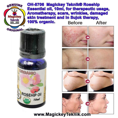 OH-8706 – Magickey Teknik® Rose Hip (Rosa Rugosa) Essential Oil