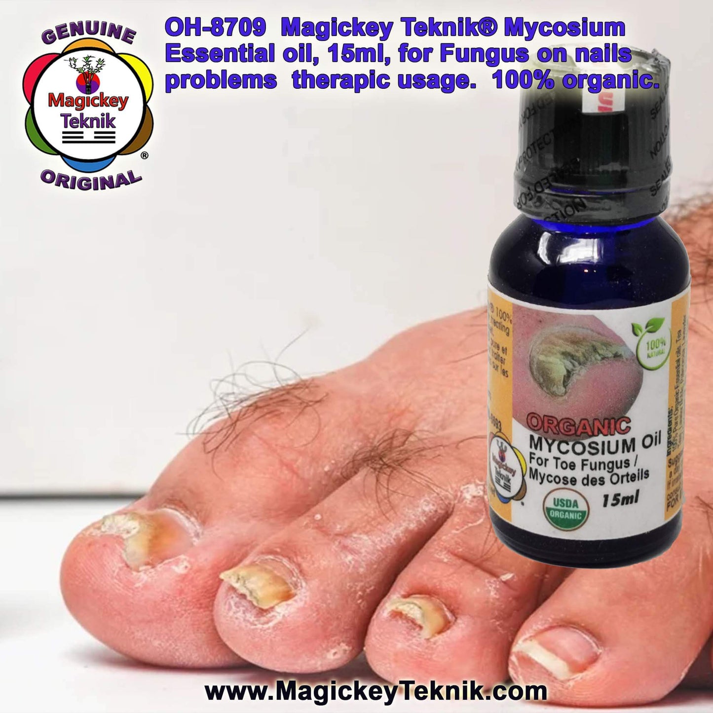 OH-8709 – Mycosium Magickey Teknik® (15 ml)