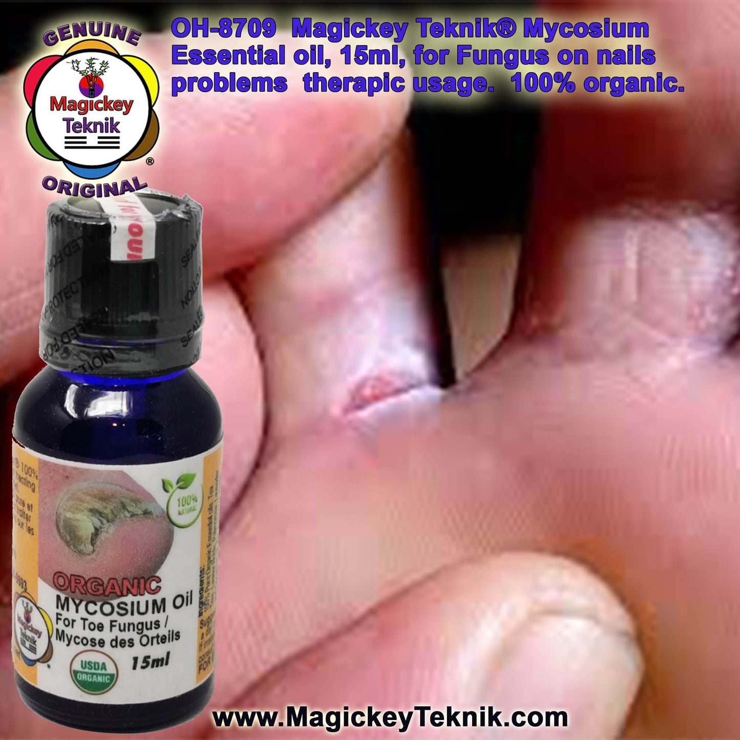 OH-8709 – Mycosium Magickey Teknik® (15 ml)
