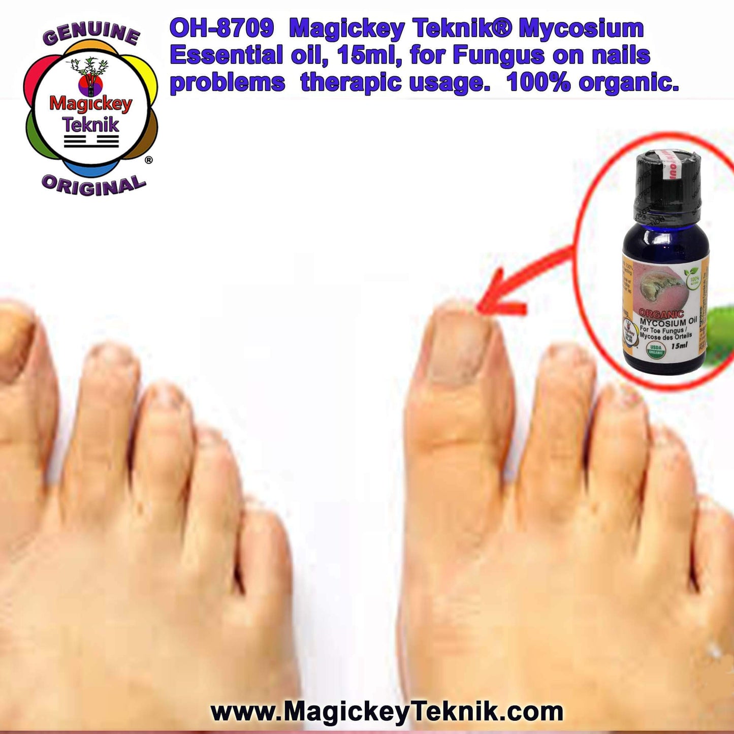 OH-8709 – Mycosium Magickey Teknik® (15 ml)