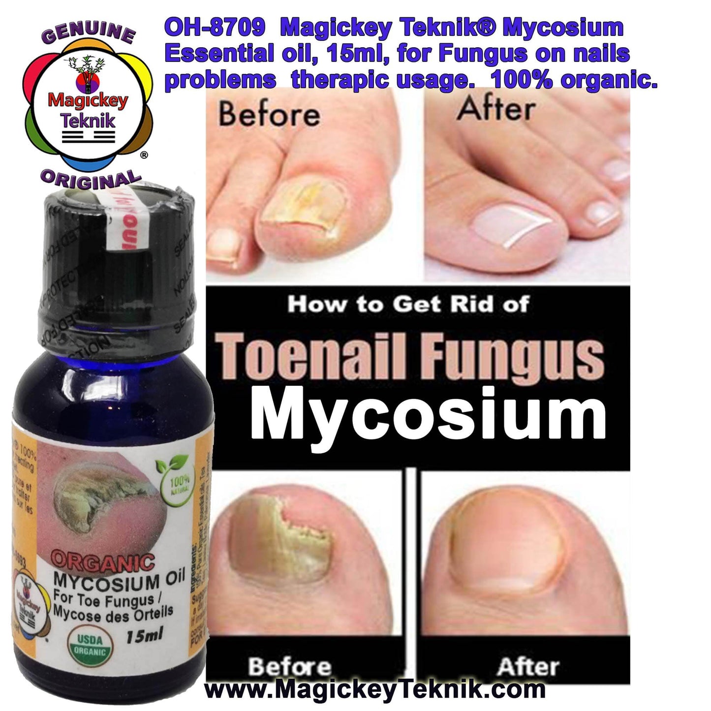 OH-8709 – Mycosium Magickey Teknik® (15 ml)