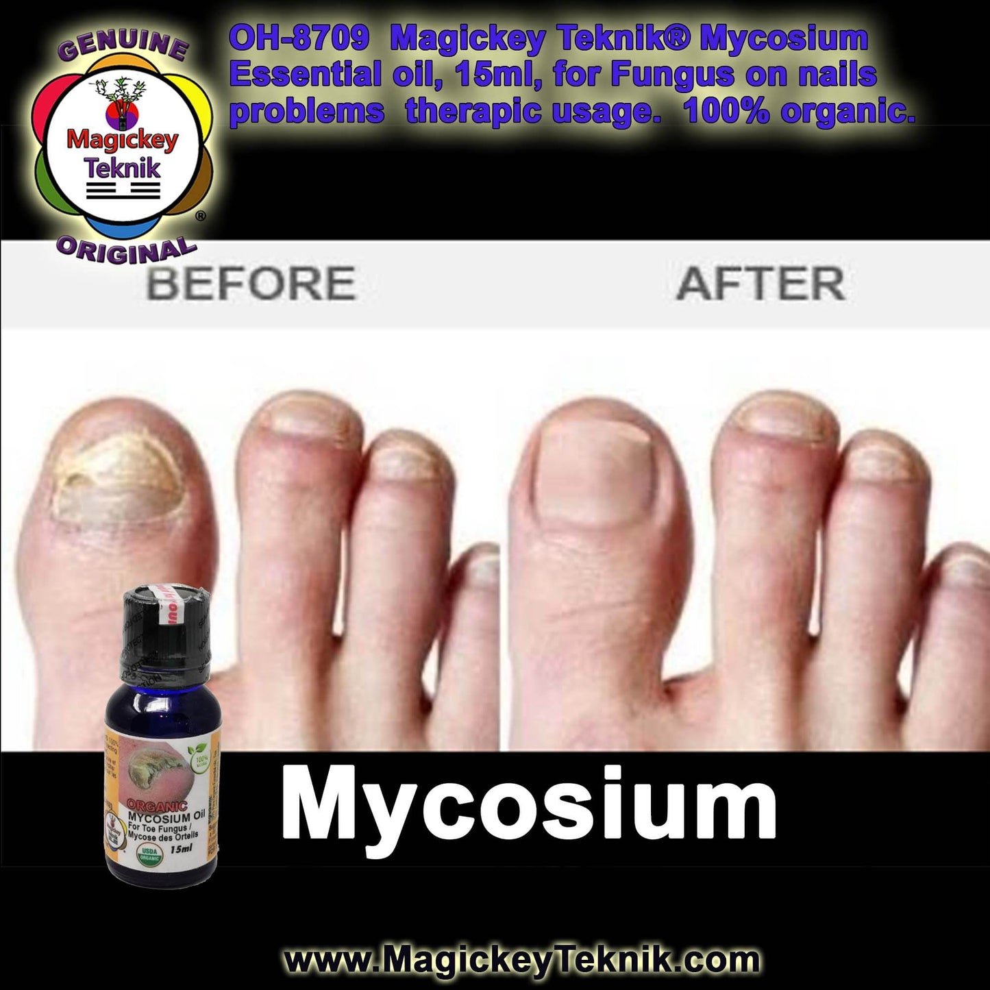 OH-8709 – Mycosium Magickey Teknik® (15 ml)