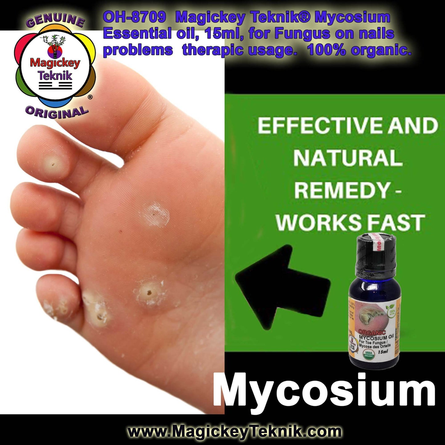 OH-8709 – Mycosium Magickey Teknik® (15 ml)