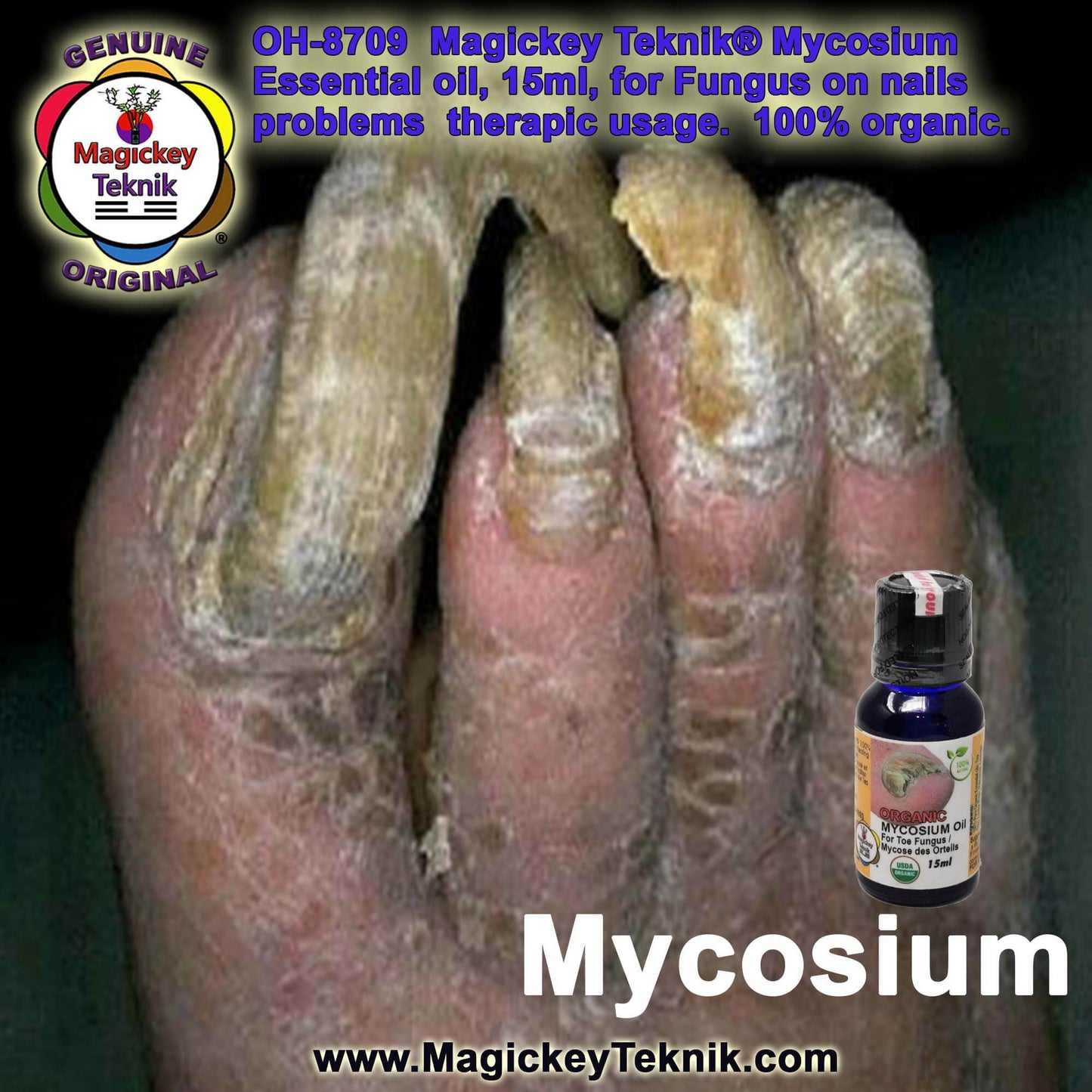 OH-8709 – Mycosium Magickey Teknik® (15 ml)