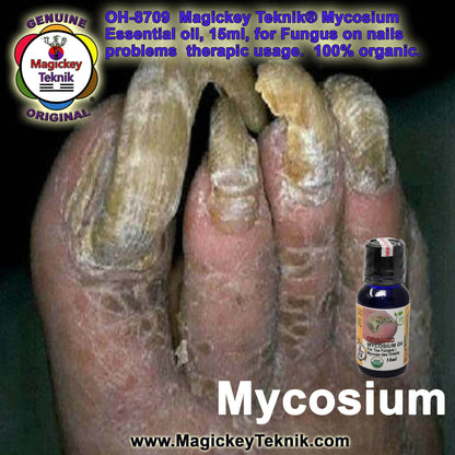 OH-8709 – Mycosium Magickey Teknik® (15 ml)